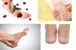 winter-ankles-care-remedies,home-remedies,skin-care-in-winter,-home-remedies-for-torn-ankles_optimized
