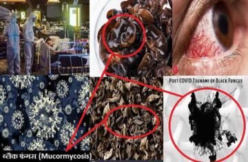 What is black fungus Know the treatment for this new disaster, क्या है ब्लैक फंगस...? कोरोना काल की इस नई आफत का जानिए सही इलाज