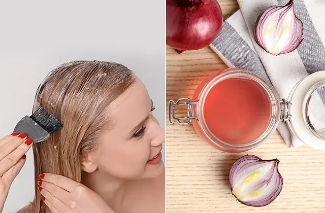 onion benefits pyaj ke Fayde, सेक्स क्षमता में वृद्धि, ब्लड शुगर कंट्रोल,प्याज का रस शैम्पू,कैंसर से बचाव,रोग प्रतिरोधक क्षमता,कानदर्द...