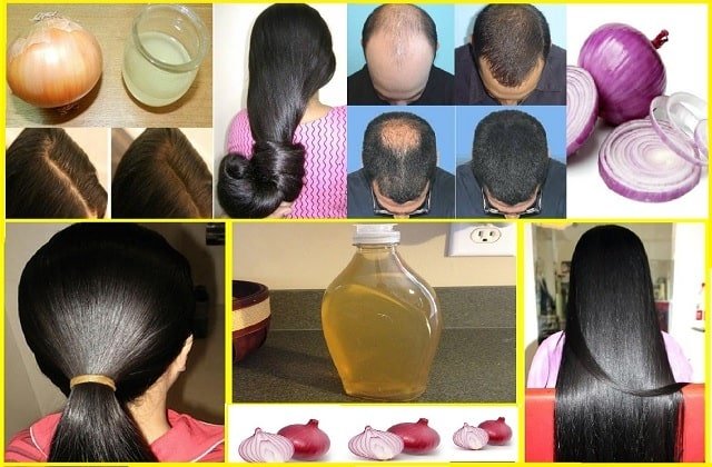 homemade hair care tips- onion juice for hair benefits-hair care routine-pyaj se baal kare majboot-min