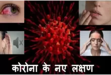 covid 19 New symptoms hearing loss-dry mouth- conjunctivitis including others