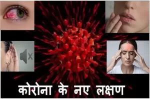 covid 19 New symptoms hearing loss-dry mouth- conjunctivitis including others