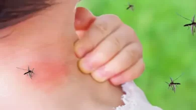 mosquito home remedy-how to get rid of mosquitoes at home-machcharo-ko-marne-ke-upay