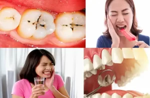 How-to-remove cavity-from teeth-at-home-tooth-decay-treatment-danto-se-kide-nikalne-gharelu-tarike