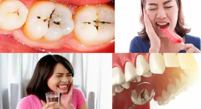 ठंडा-गर्म खाते ही आपके भी दांतों में तेजी से होता है दर्द?कैविटी है ये,इन नुस्खों से दूर करें दांतों के कीड़े