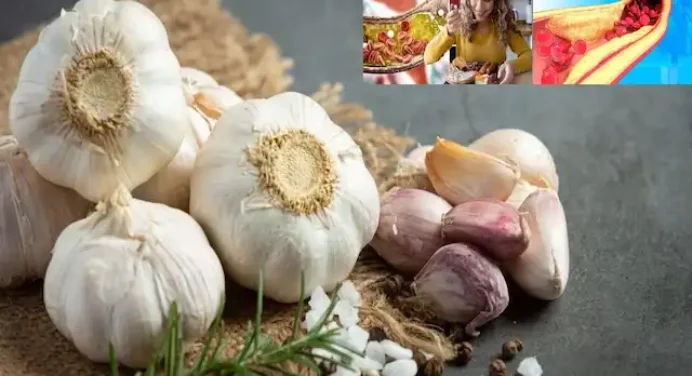 Garlic Nutrition: कोलेस्ट्रॉल करना है कम,तो लहसुन खाना हरदम