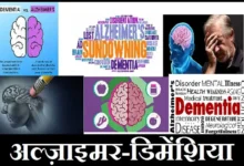 World-Alzheimer-and-Dementia-death-rate Know-the-Statistics 