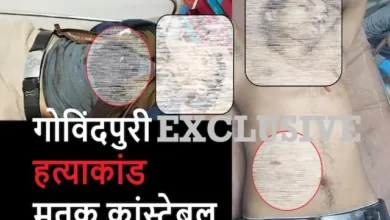 Govindpuri Murder row-Police Cons KiranPal Murder Exclusive pic and postmortem report