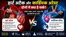 Difference Between Heart Attack and Cardiac Arrest-हार्ट अटैक और कार्डियक अरेस्ट के बीच अंतर दिखाती हिंदी मेडिकल इन्फोग्राफिक, जिसमें लक्षण, कारण और CPR की जानकारी दी गई है।